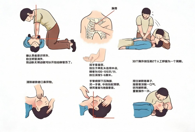 从张雪峰到哈尔克 足球世界与心源性猝死的二十年攻防战