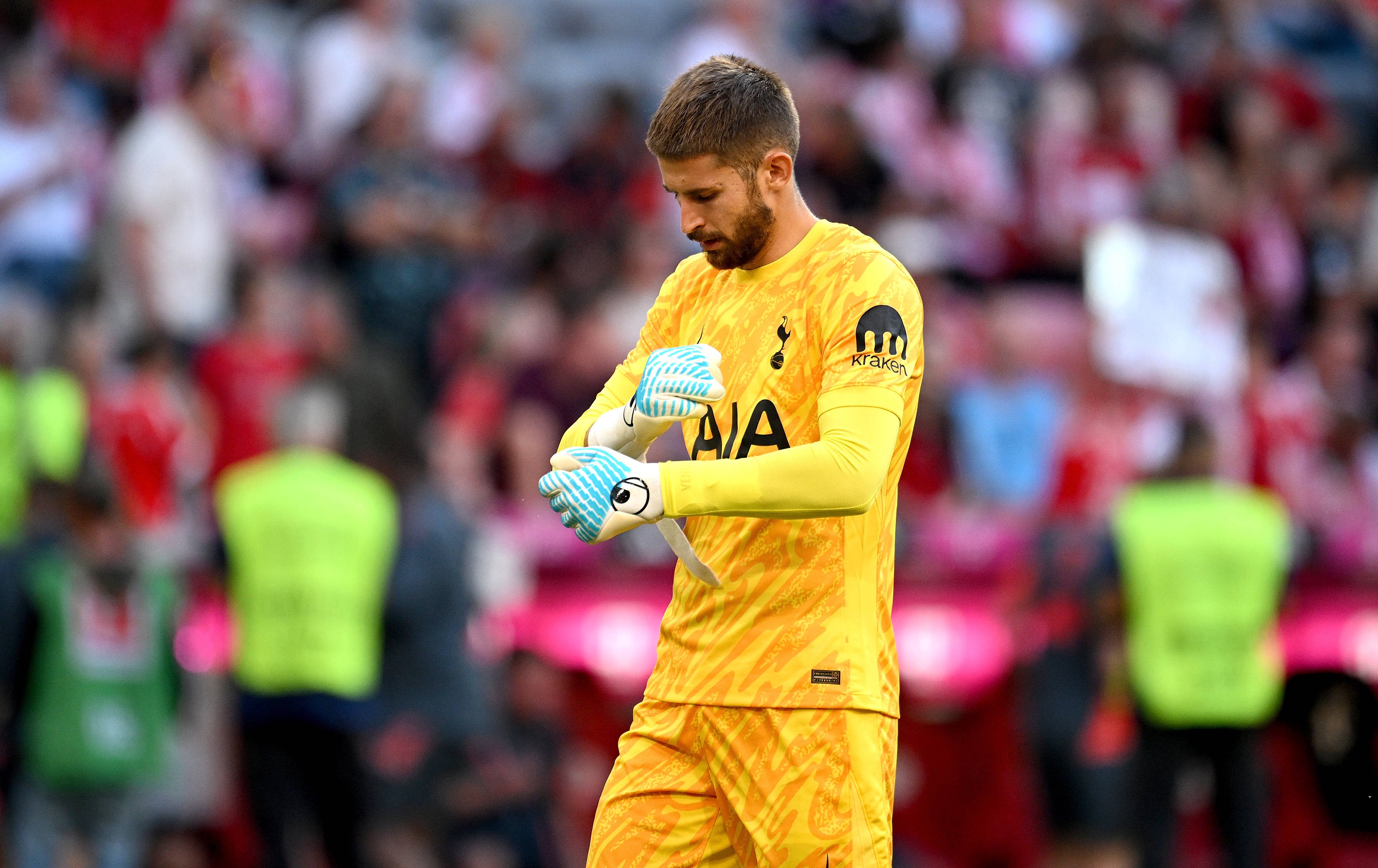 维卡里奥带疝伤作战数月 国际比赛日后手术预计休战一月