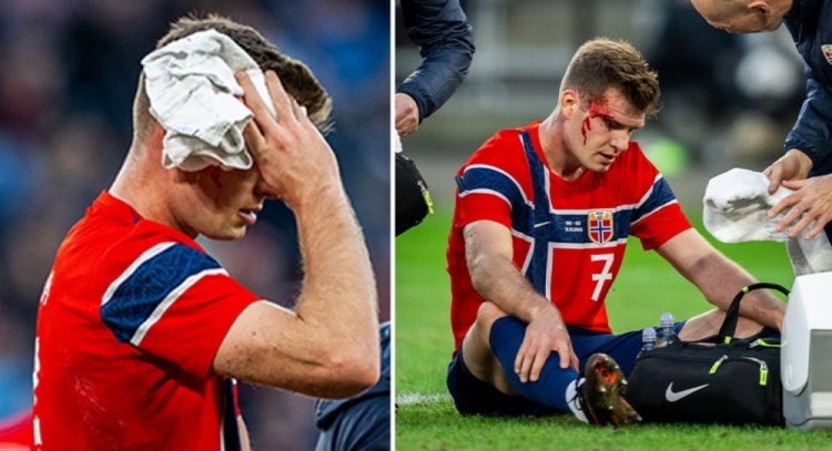 马竞锋线警报 瑟尔洛特头部再伤出战巴萨成疑