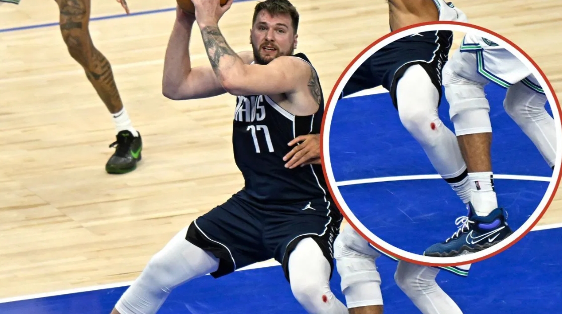 东契奇库里膝盖渗血真相:地板擦伤疤痕撕裂 非药水 东契奇库里膝盖渗血真相:地板擦伤疤痕撕裂 非药水